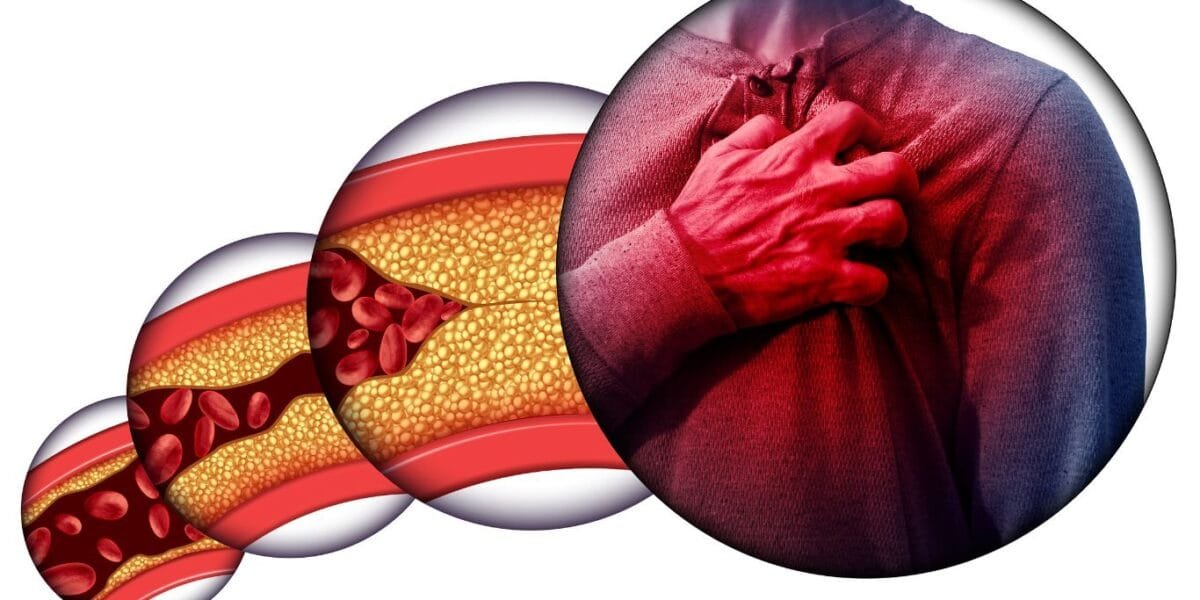 Heart Disease  Coordinated Medicine Foundation