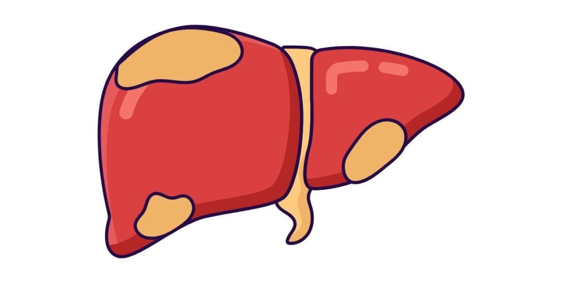 NAFLD  Coordinated Medicine Foundation