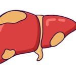 NAFLD  Coordinated Medicine Foundation