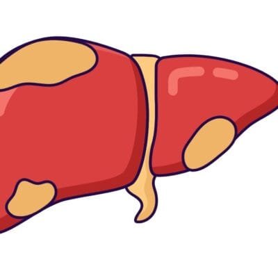 NAFLD  Coordinated Medicine Foundation